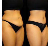 Customer-supplied before and after photo comparison